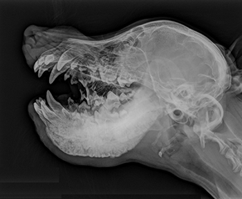 Lastra radiologica di mandibola colpita da CMO